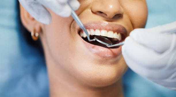 Best Weekend Emergency Dental Services in Peachtree City, GA